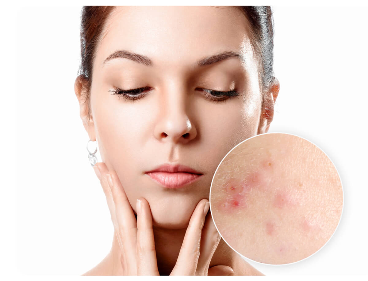 Vit. B3 Topical Serum For Oily Skin