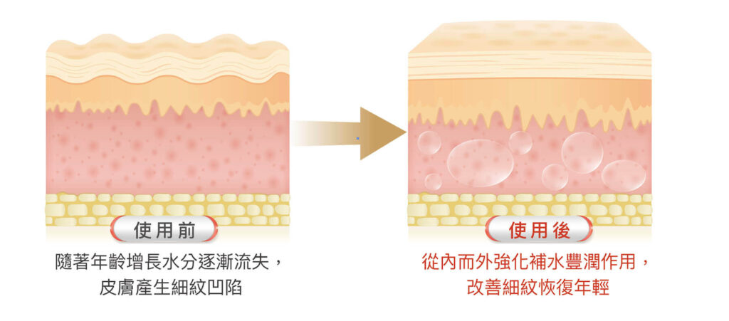 Anhydrous Hyaluronic Acid Topical Gel Effects